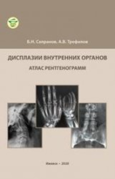 Б.Н. Сапранов. Дисплазии внутренних органов