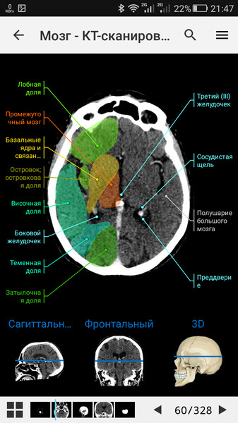 e-Anatomy5